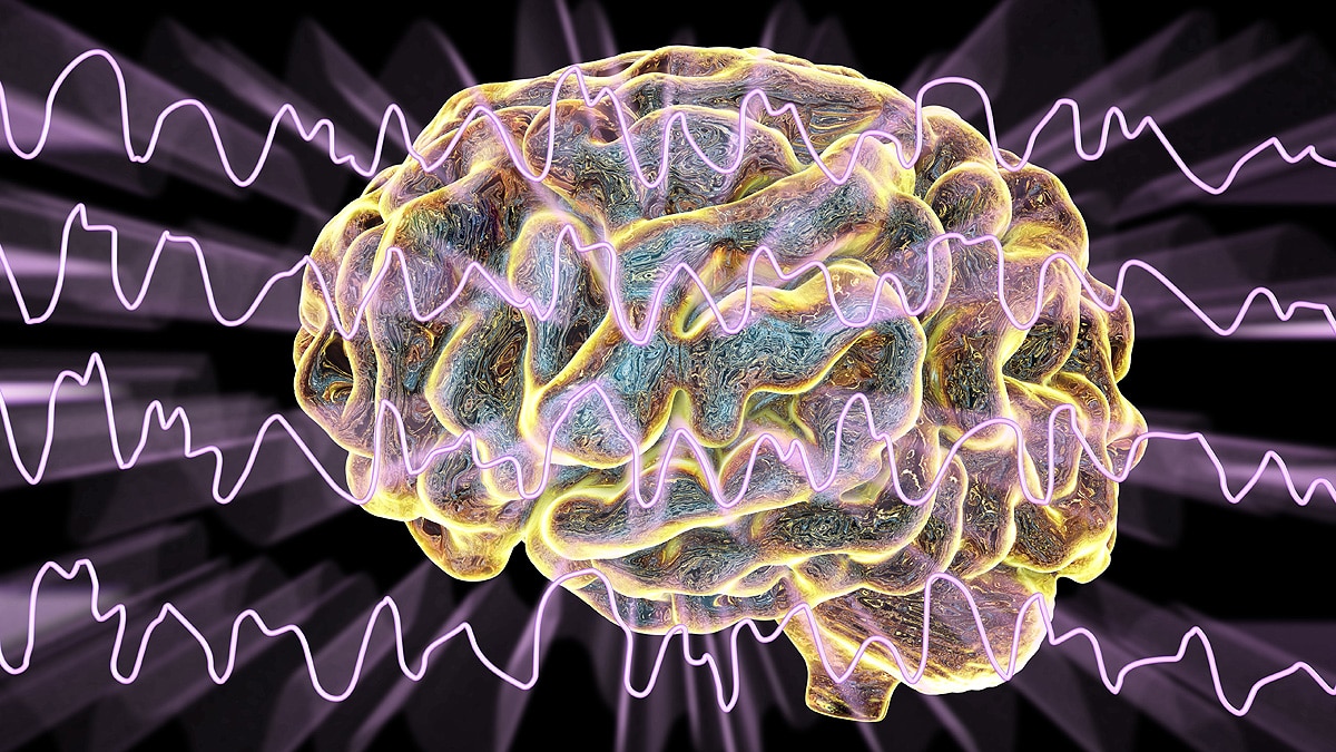 First Recording Of Dying Human Brain 