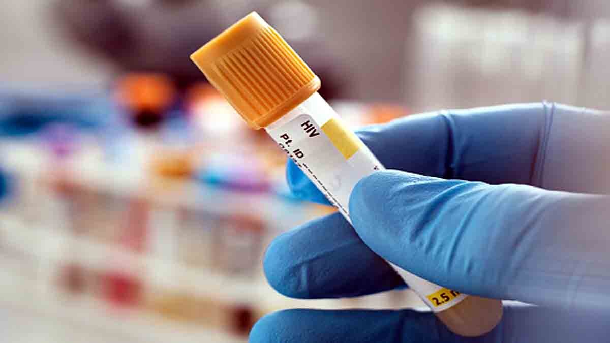 Netherlands HIV Variant