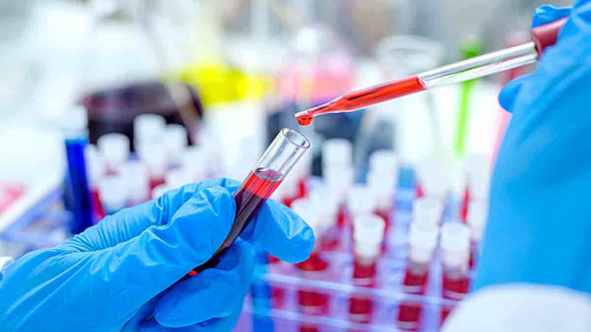 Netherlands HIV Variant
