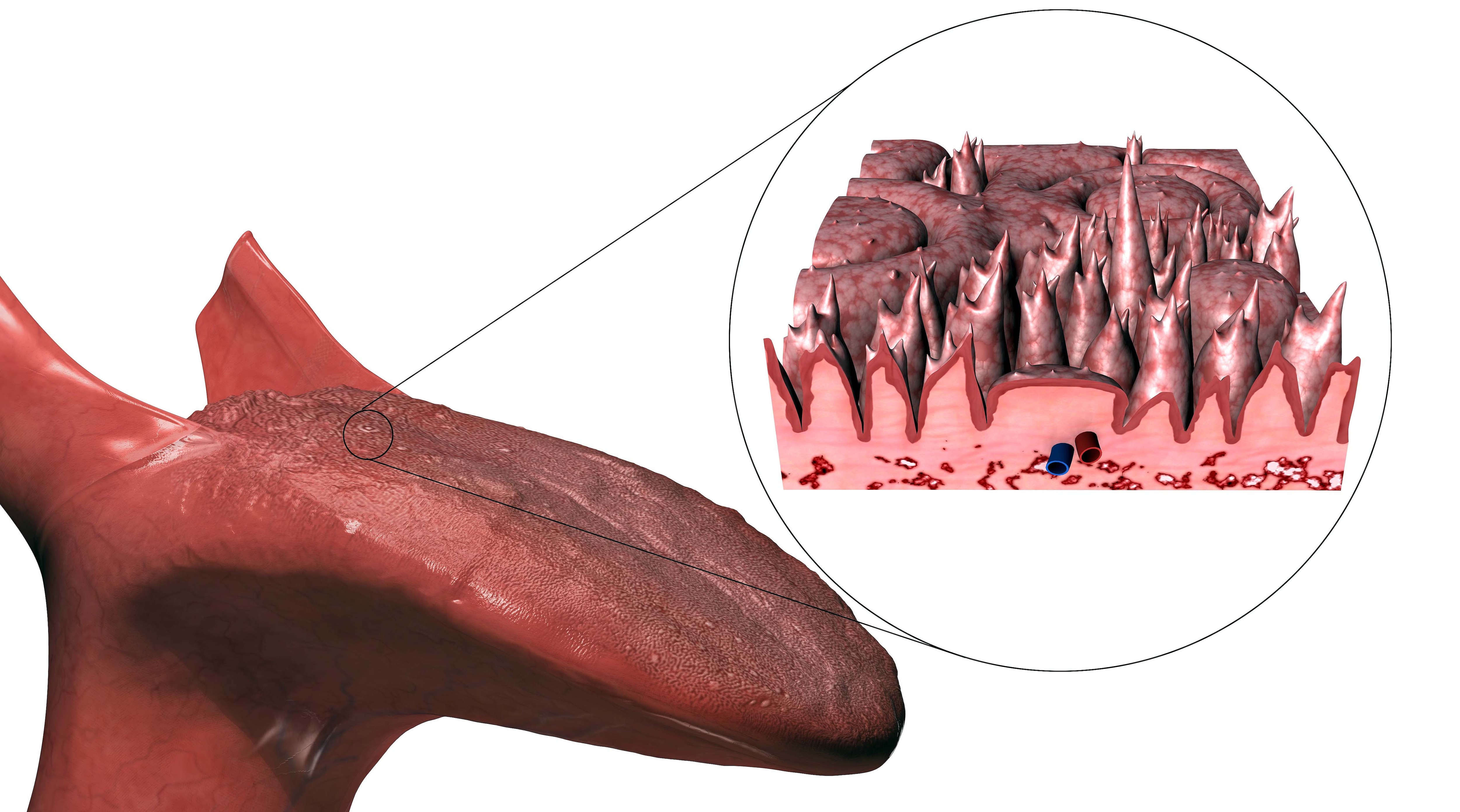 black hairy tongue syndrome