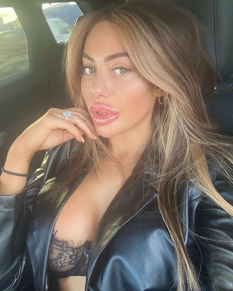 Chloe Ferry
