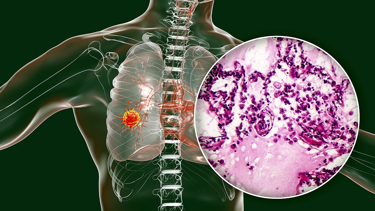 Why NASA Put Men on Priority?