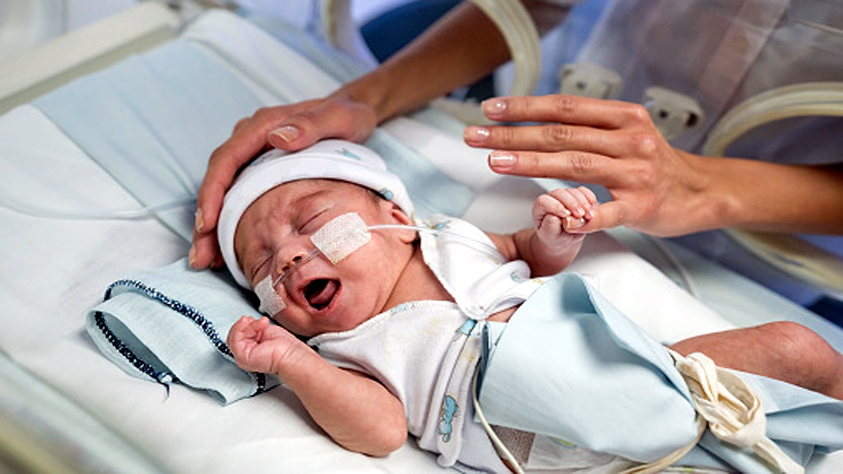 Baby with 2 penises in Brazil