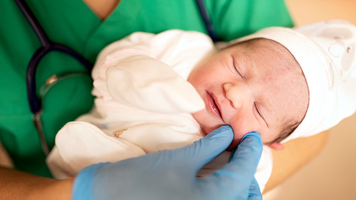 Baby with 2 penises in Brazil