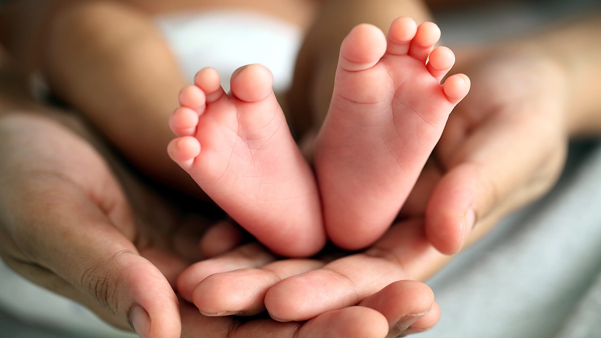 Baby with 2 penises in Brazil