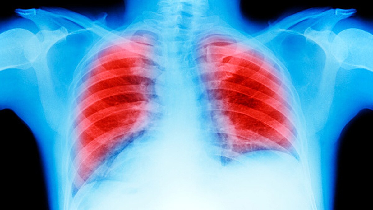 World's most polluted city Bhiwadi