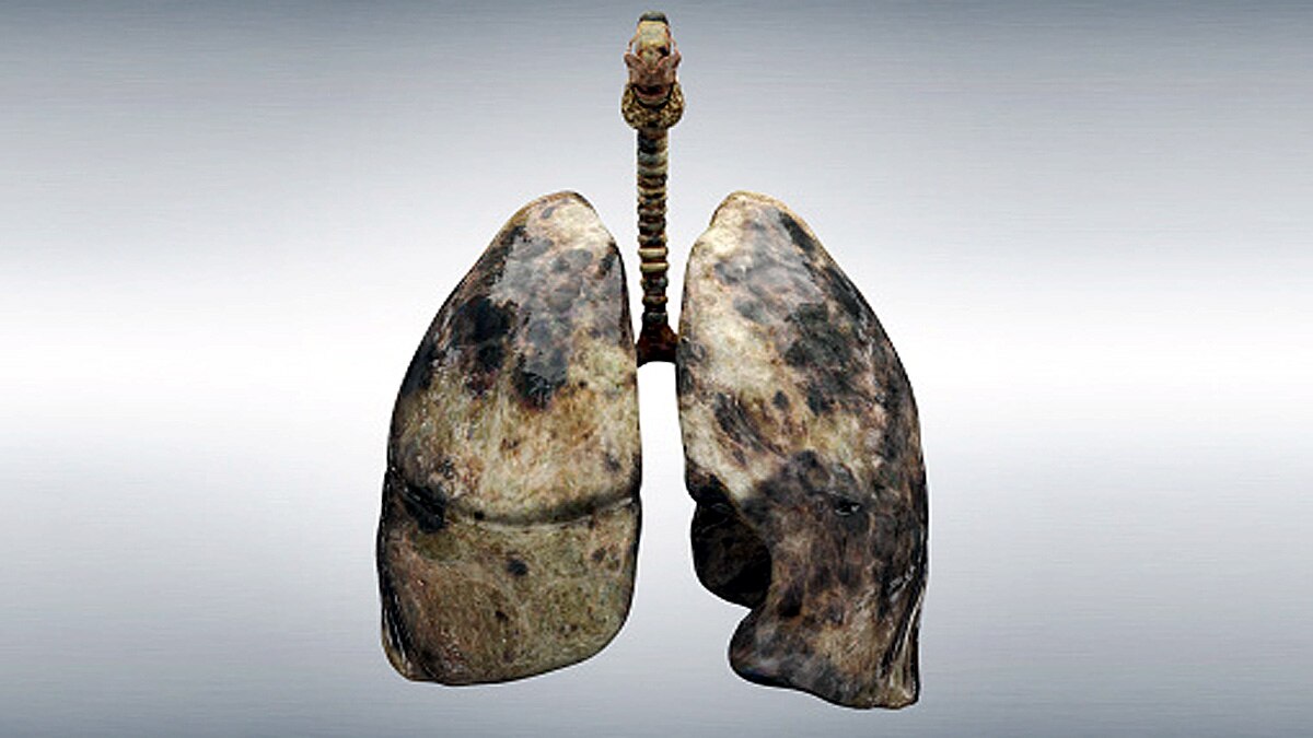 World's most polluted city Bhiwadi