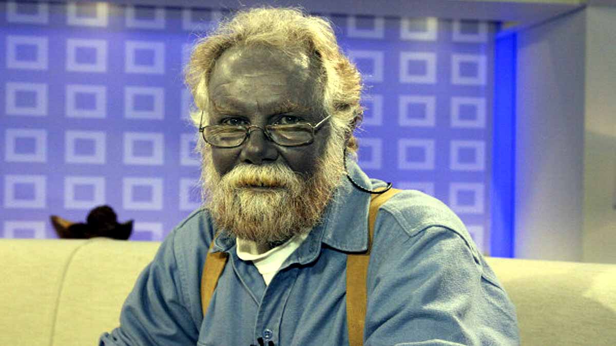 Blue Blood In Humans