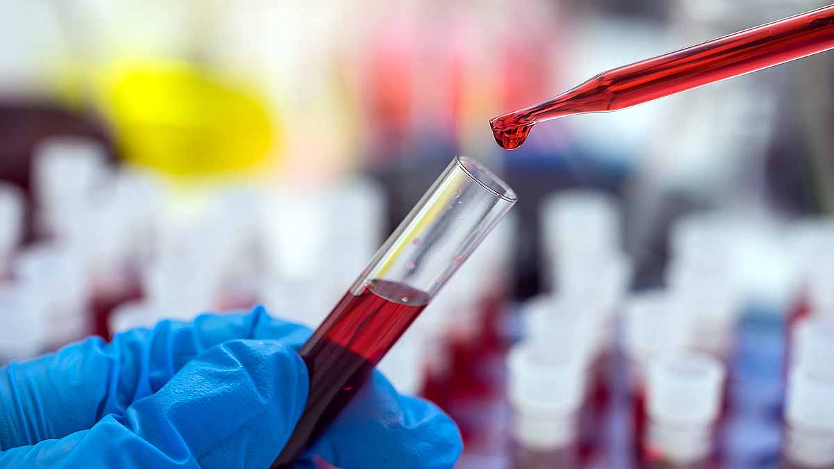 Blue Blood In Humans