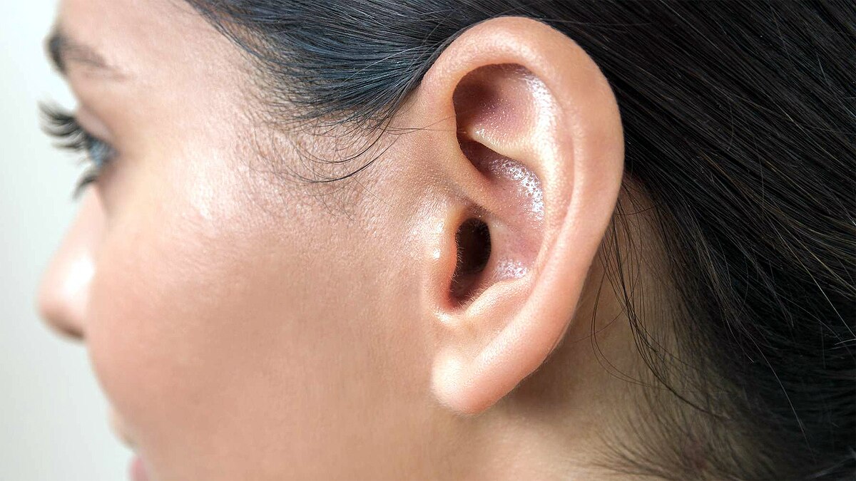 3D Printed Ears