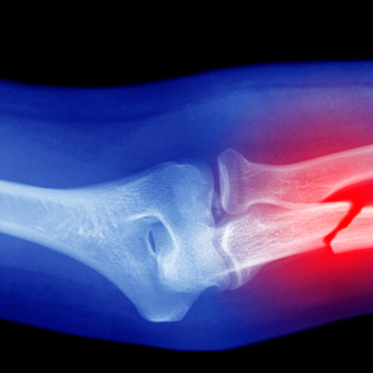 प्रतीकात्मक फोटो (Getty)