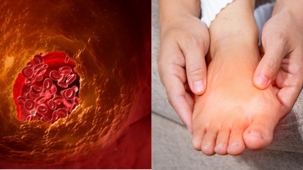 कोलेस्ट्रॉल लेवल हाई होने पर पैरों में दिखते हैं ये संकेत (Photo Credit: Getty Images)