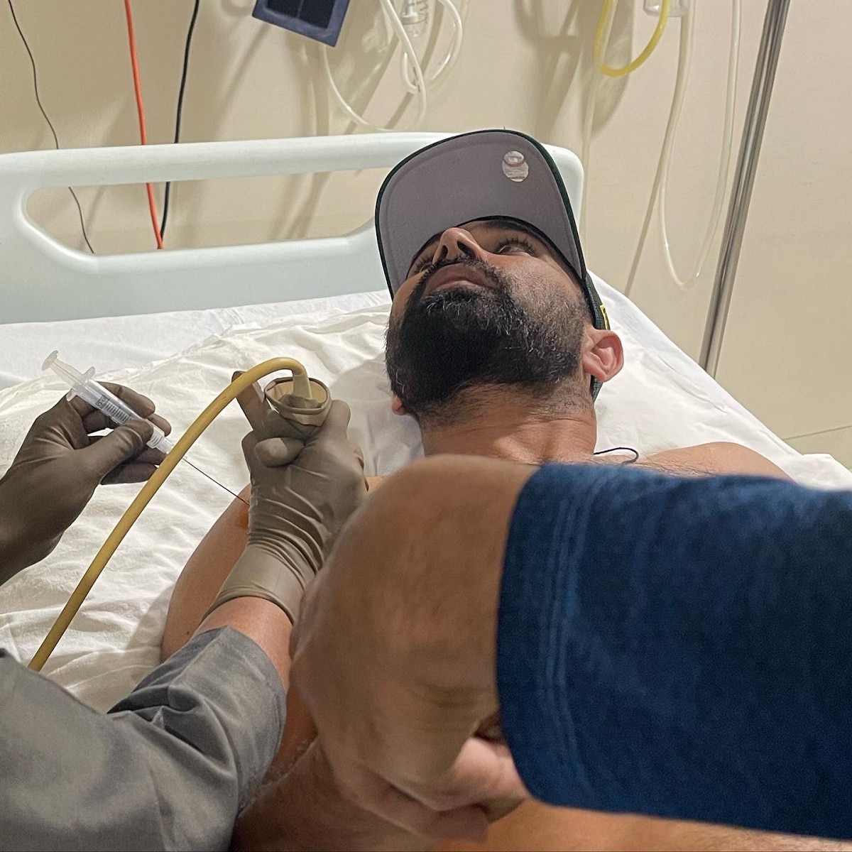 इलाज कराते शमी