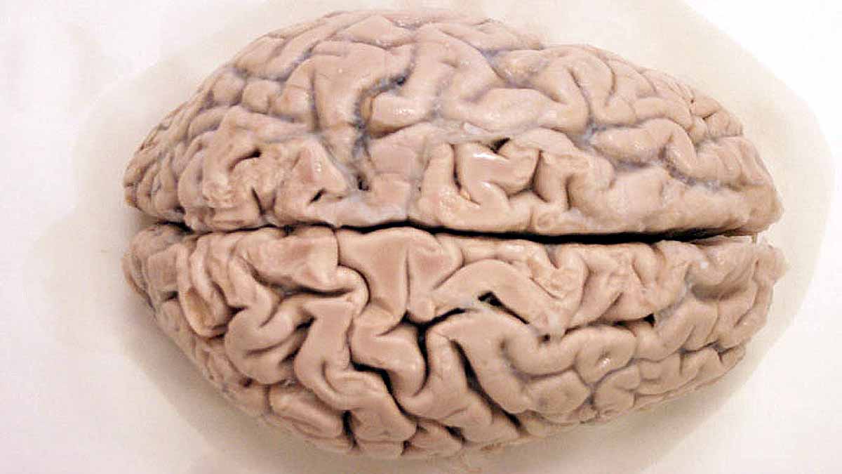 Climate Change Shrinking Brain