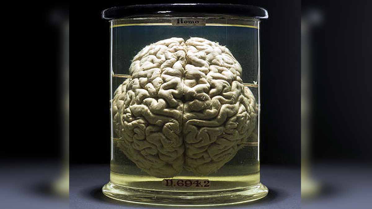 Climate Change Shrinking Brain