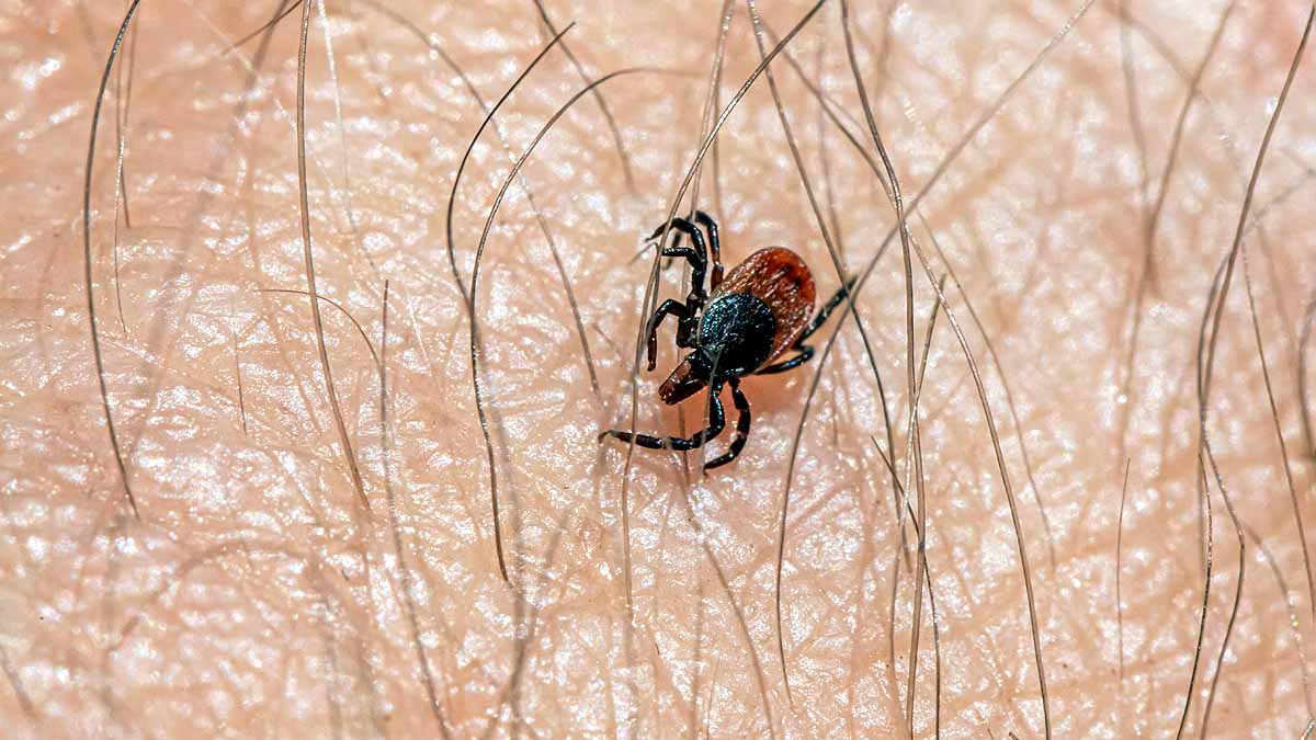 Tick Borne Virus, China 