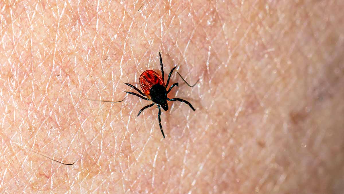 Tick Borne Virus, China 