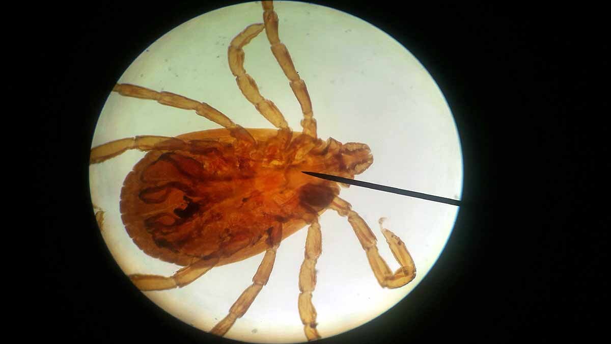 Tick Borne Virus, China 