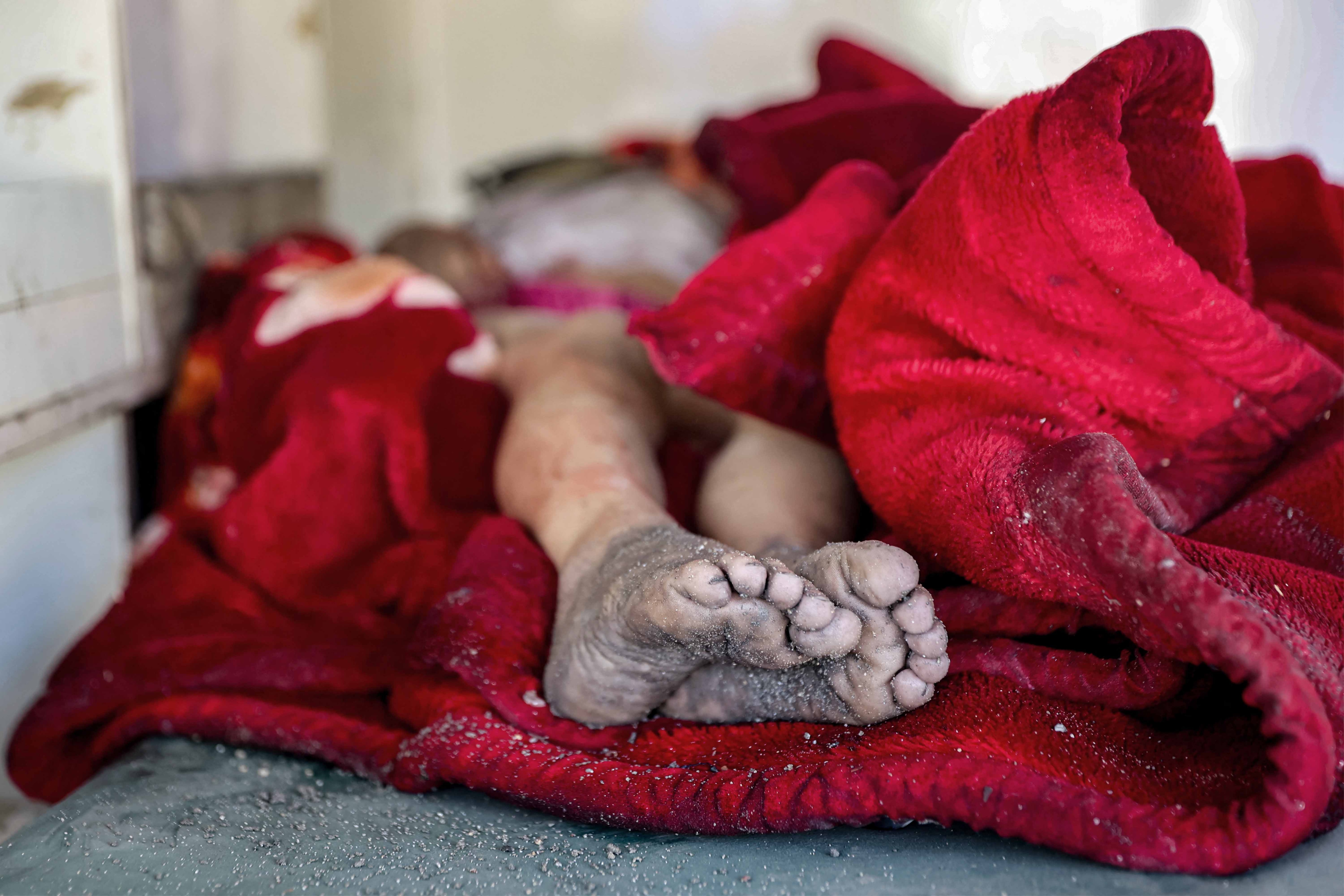 gaza israel war children condition