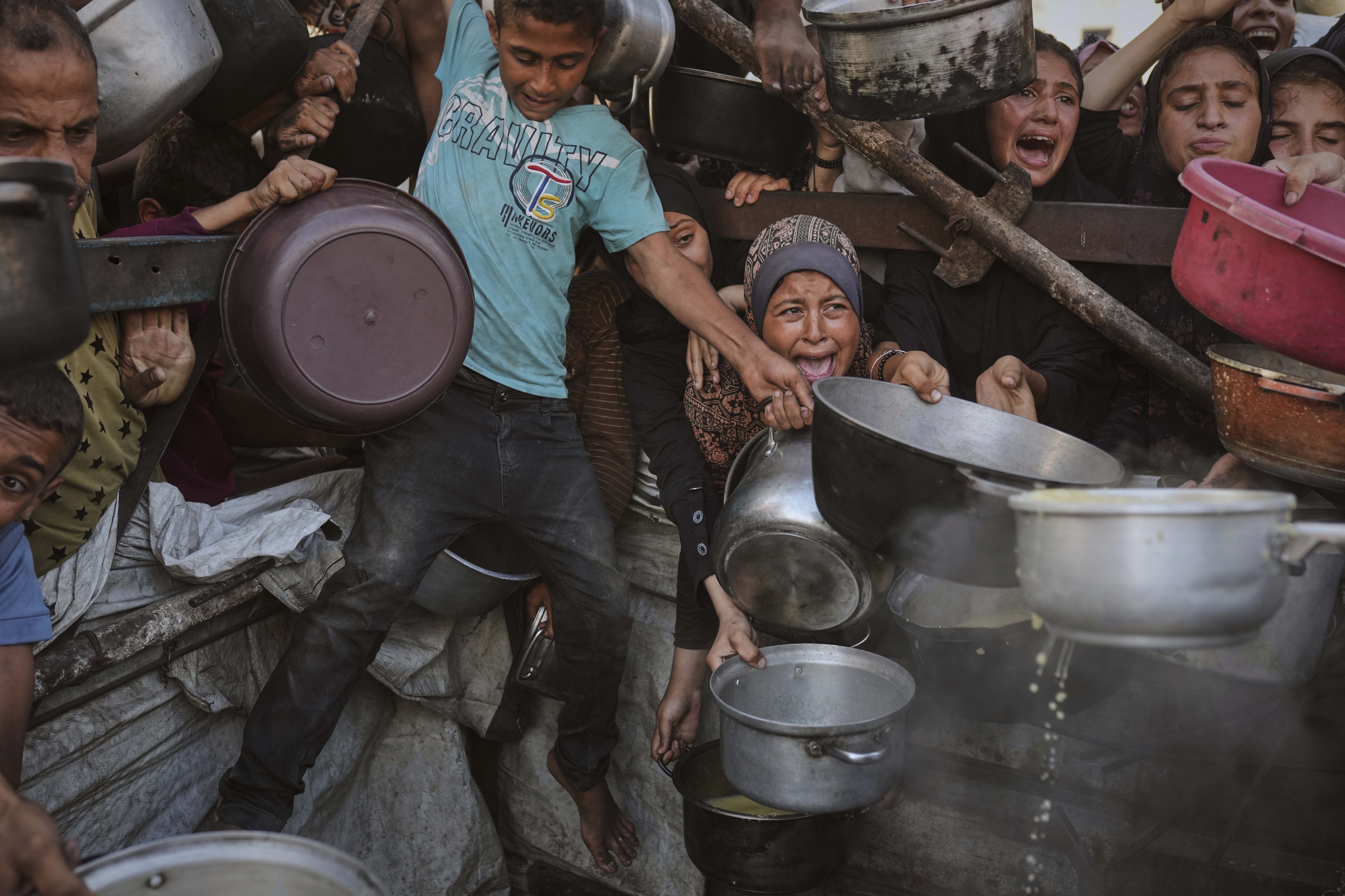 gaza food hunger malnutrition