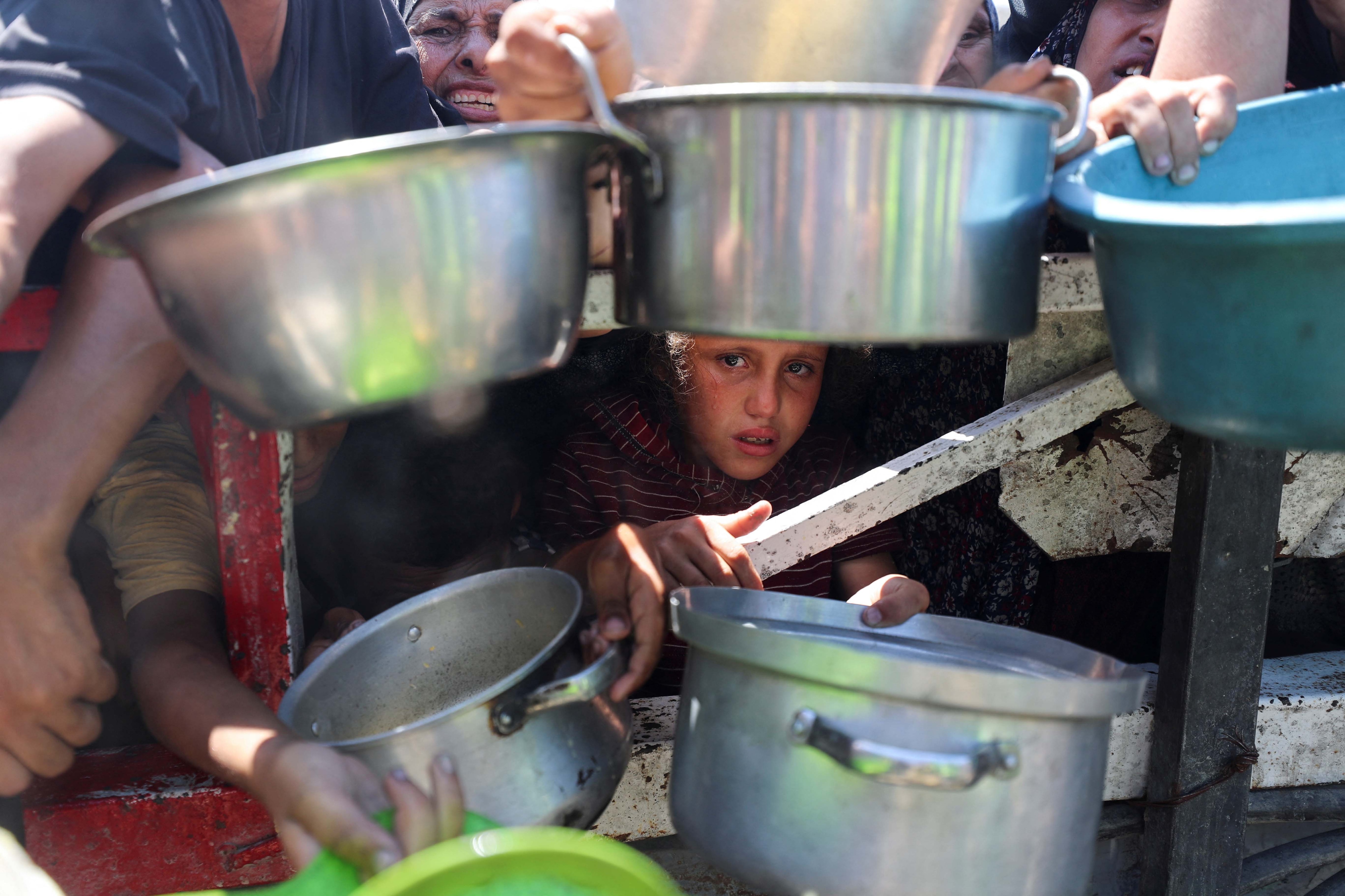 gaza food hunger malnutrition