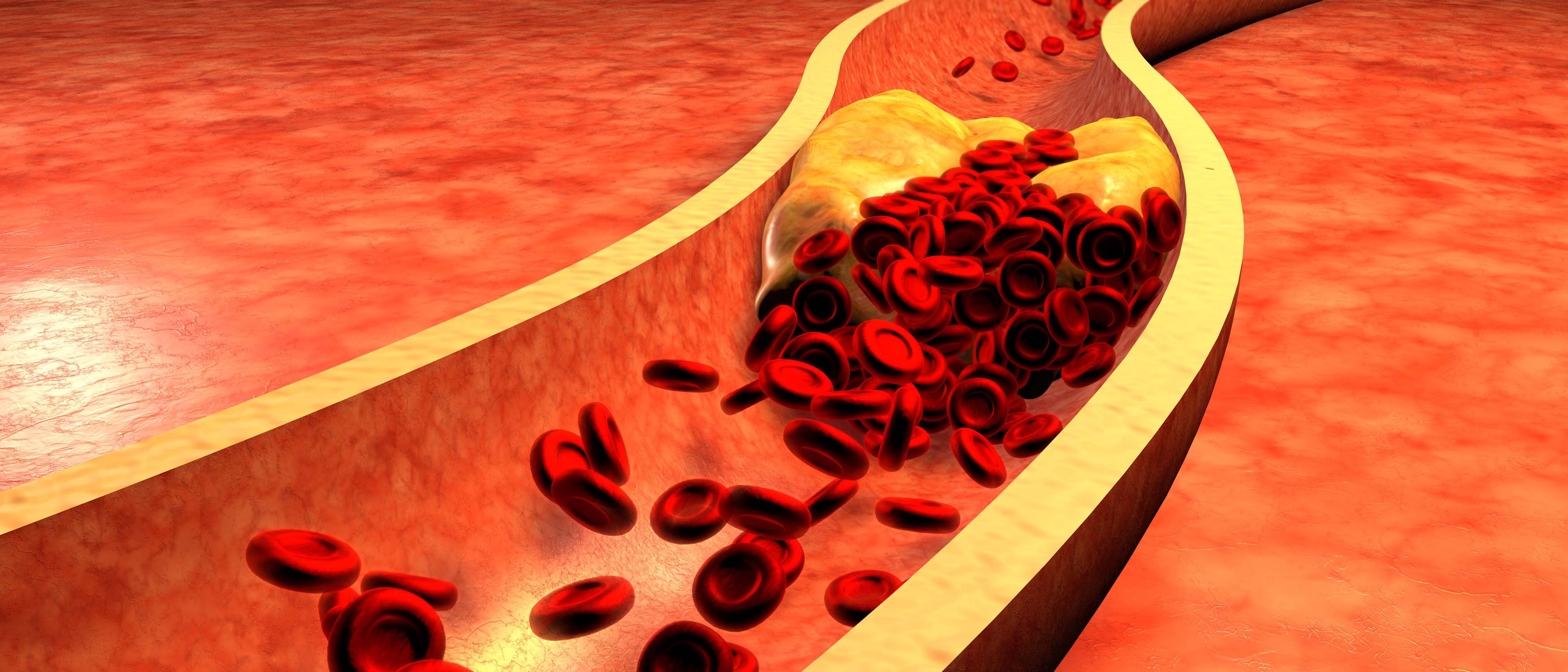 tricks to reduce cholesterol