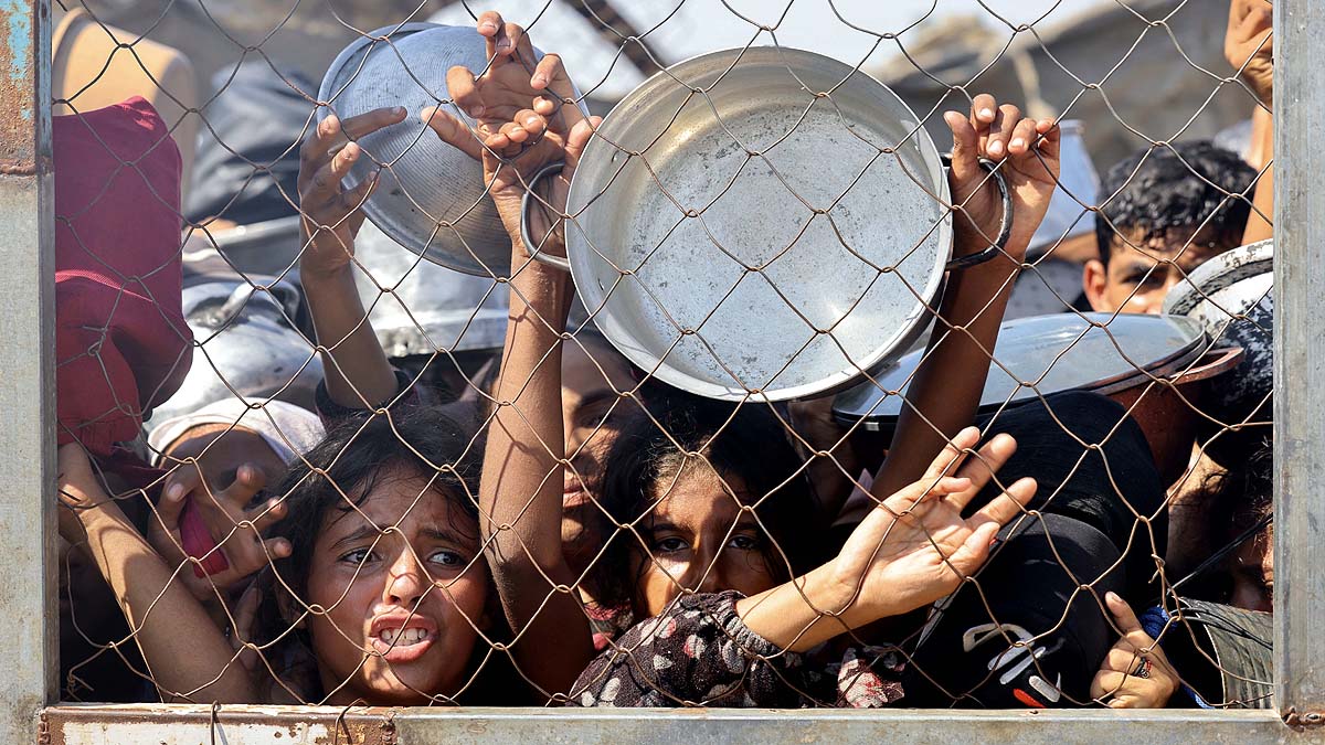 Gaza malnourished Children 