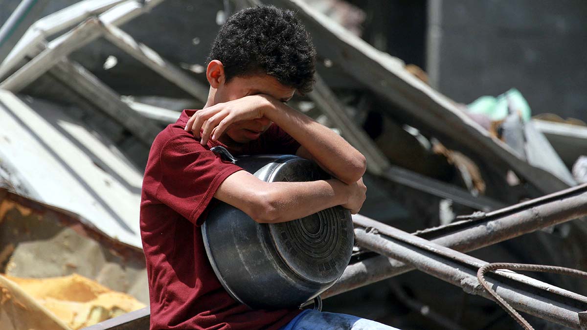 Gaza malnourished Children 