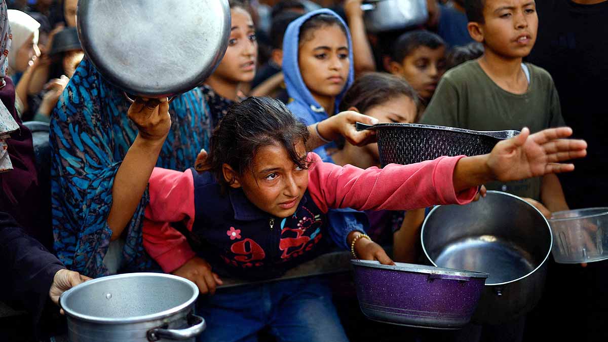 Gaza malnourished Children 