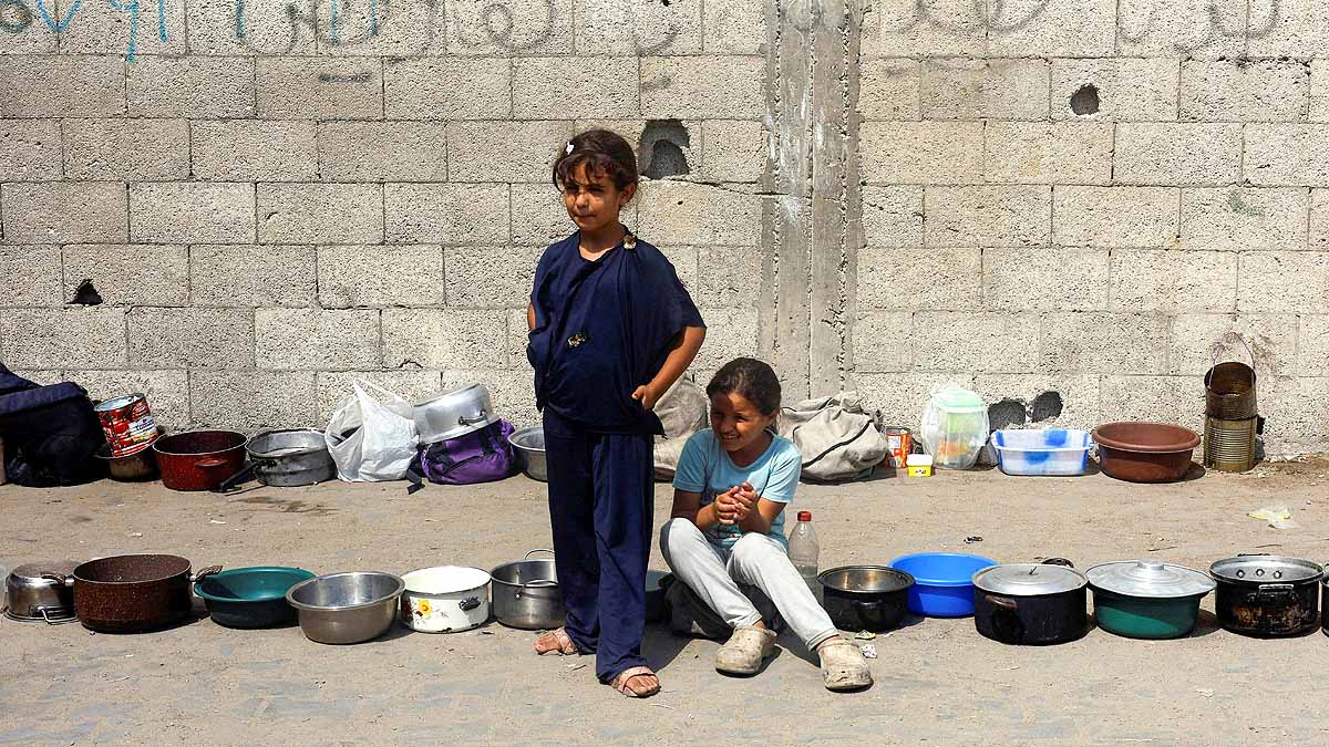 Gaza malnourished Children 