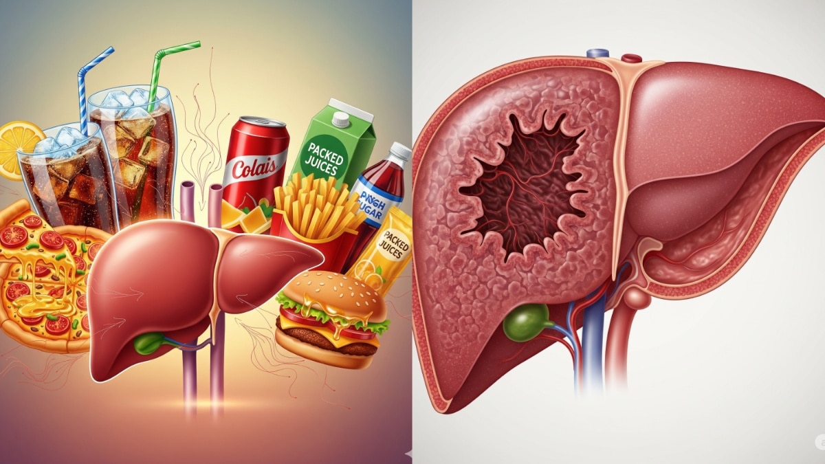 how to take care of liver (Photo: AI generated)