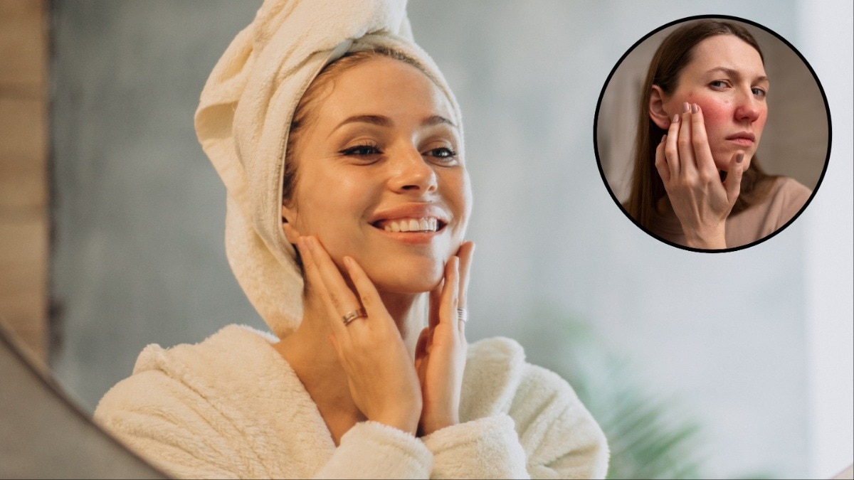 Winter skincare tips