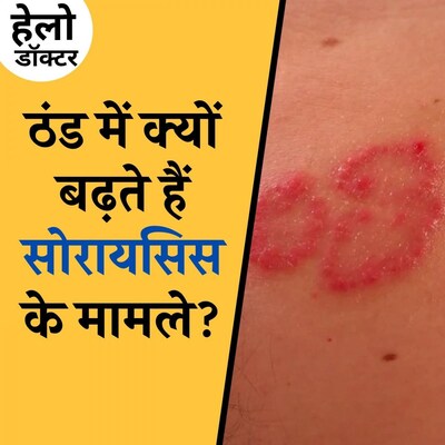 स्किन पर सर्दियों में लाल निशान, तो ऐसे रखें ध्यान: हेलो डॉक्टर, Ep 26