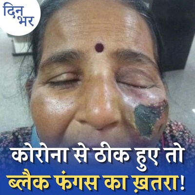 कोरोना से तो बच गए लेकिन उसके बाद होनेवाली ये बीमारी आंख और जान ले रही है: दिन भर, 7 मई