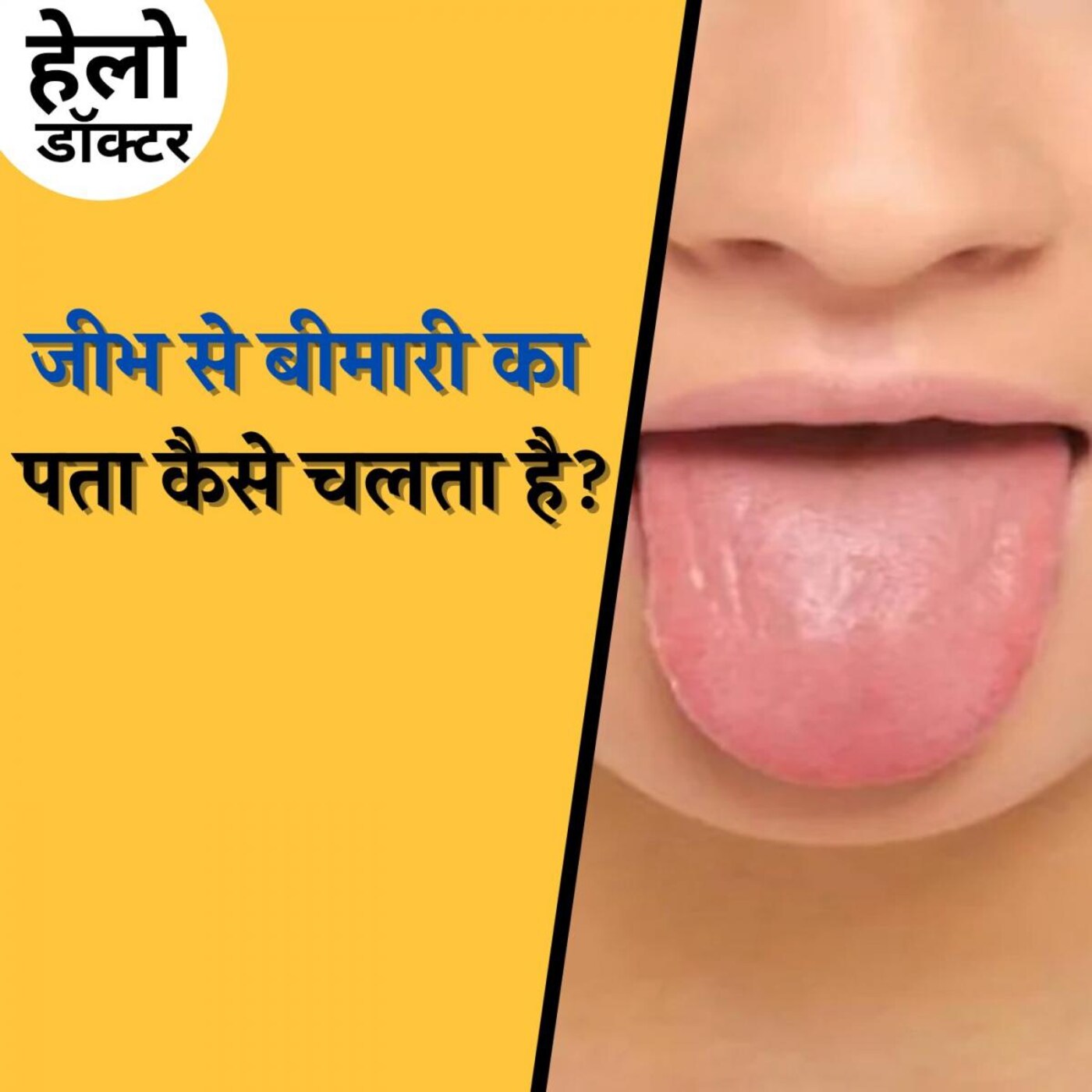 बीमारियों का घर है जीभ, ठीक से साफ़ नहीं किया तो भुगतना पड़ेगा: हेलो डॉक्टर, Ep 118 बीमारियों का घर है जीभ, ठीक से साफ़ नहीं किया तो भुगतना पड़ेगा: हेलो डॉक्टर, Ep 118