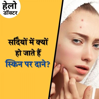 सर्दियों में स्किन पर नारियल तेल का इस्तेमाल भारी पड़ सकता है: हेलो डॉक्टर, Ep 134