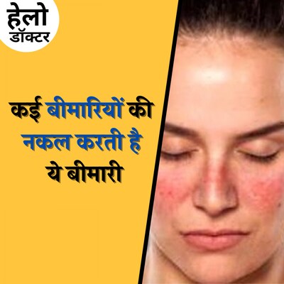 Lupus बीमारी, जिसमें सूरज की रौशनी जानलेवा हो सकती है :हेलो डॉक्टर, Ep 158