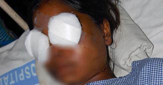 बलात्कार का विरोध करने पर आंख फोड़ दी