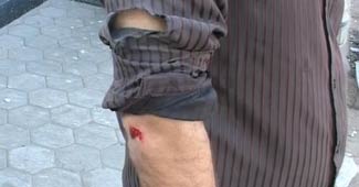 आजतक के रिपोर्टर से मारपीट