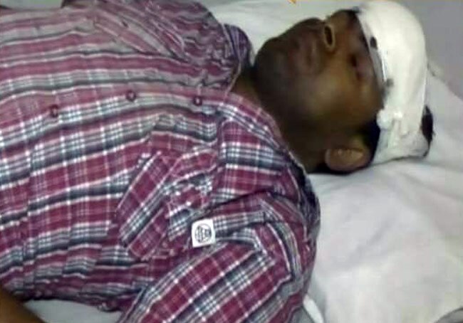 नाबालिग की कार से घायल