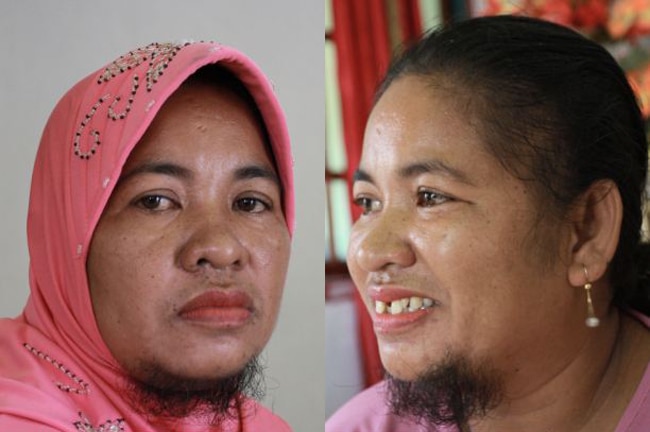 ऑगस्तिना