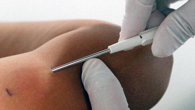 ये चिप बताएगी कि आपको कब खाना बंद करना है