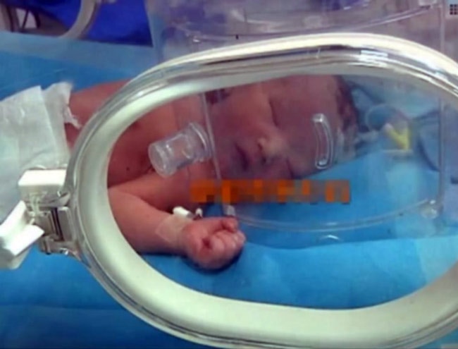 बच्चे को सुरक्षित बचाया गया