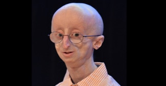 17 वर्षीय सैम बर्न्स