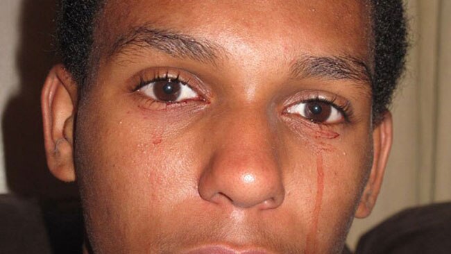 काल्विनो इनमैन