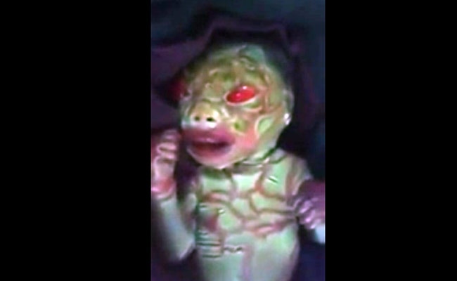 छत्तीसगढ़ के केशकाल में विचित्र रंग-रूप लिए पैदा हुई बच्‍ची