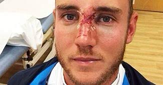 स्टुअर्ट ब्रॉड