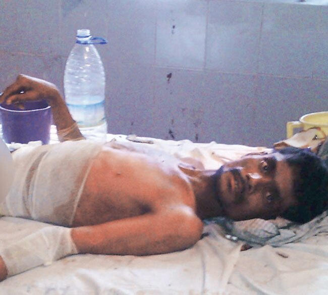 इसी शख्स को डॉक्टरों में मुर्दा बताकर पोस्टमार्टम के लिए भेज दिया था