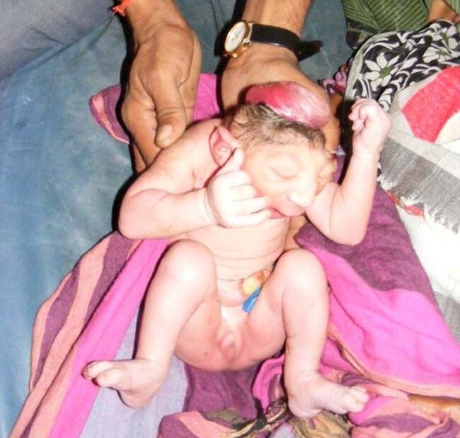 हमीरपुर में जन्मा अद्भुत बच्चा