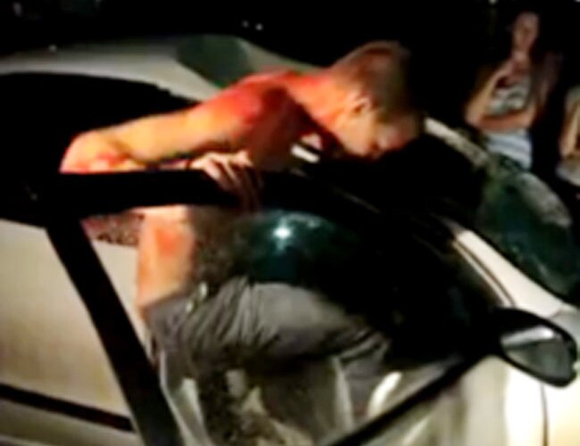 दुर्घटना में घायल व्यक्ति‍